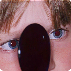 Сходящееся косоглазие